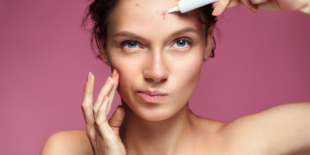 Article Thumbnail - Treating Acne with Laser Technology
