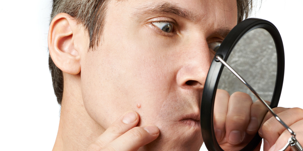 Ins and Outs of Male Acne - Prejuvenation Article Banner