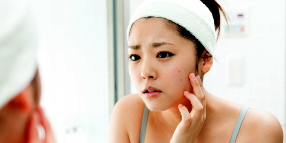Do You Know The Biggest Acne Risk Factors? - Prejuvenation Article Banner