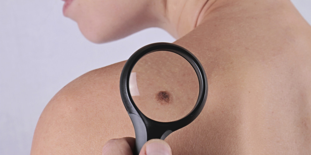 May is Melanoma Awareness Month - Prejuvenation Article Banner