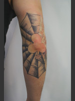 Before Photo Quanta Q-Plus C Laser Tattoo Removal #71 - Prejuvenation Before & After