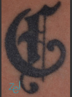 Before Photo Treatment of Symbol Tattoo - Prejuvenation Before & After