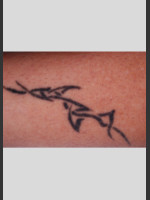 Before Photo PicoWay Tattoo Removal of Barb Wire - Prejuvenation Before & After