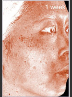 After Photo DefenAge Clinical Power Trio - Prejuvenation Before & After