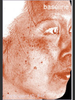 Before Photo DefenAge Clinical Power Trio - Prejuvenation Before & After