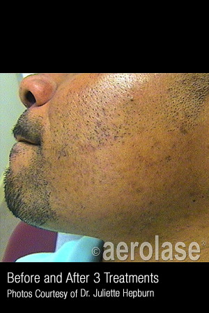 After Photo