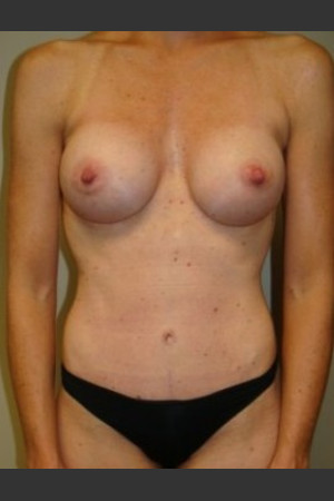 After Photo