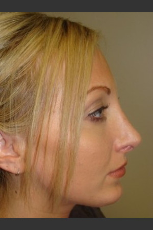 After Photo
