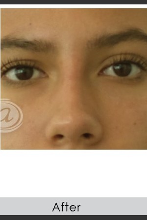 After Photo