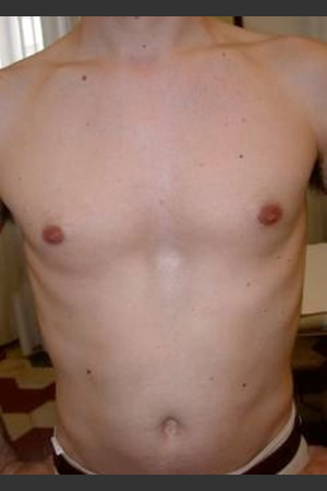 After Photo