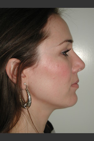 After Photo