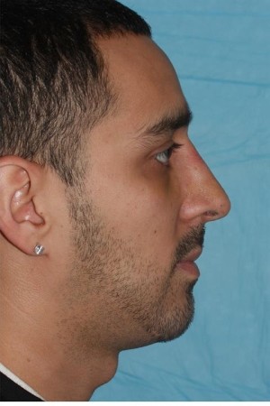 After Photo