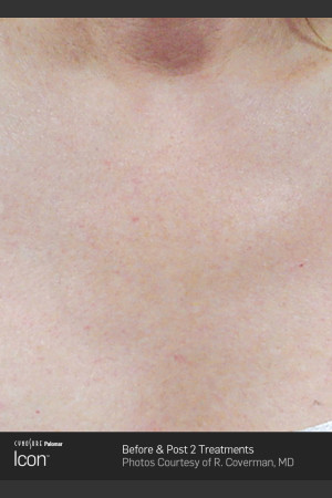 After Photo