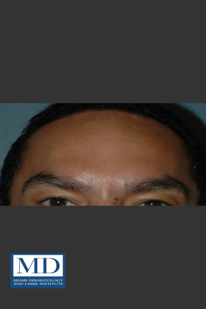 After Photo