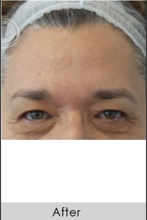 After Photo