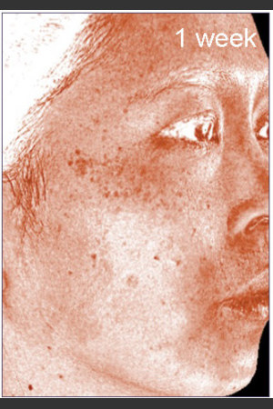 After Photo for DefenAge Clinical Power Trio -  - Prejuvenation