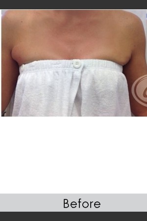 Before Photo