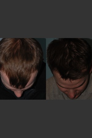 After Photo