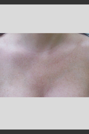 After Photo