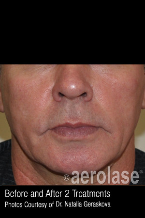 After Photo