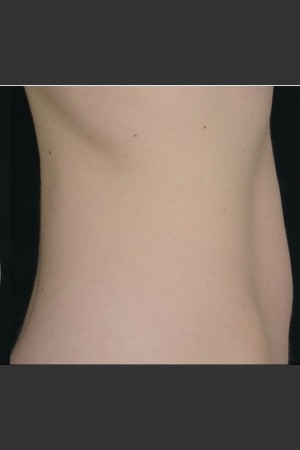 After Photo