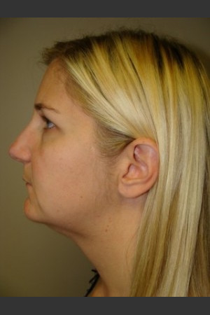 After Photo