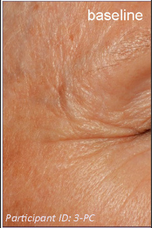 Before Photo for DefenAge Clinical Power Trio -  - Prejuvenation