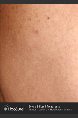 After Photo