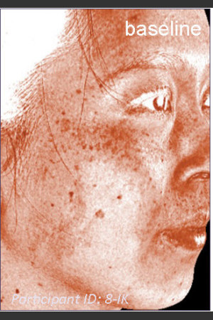 Before Photo for DefenAge Clinical Power Trio -  - Prejuvenation
