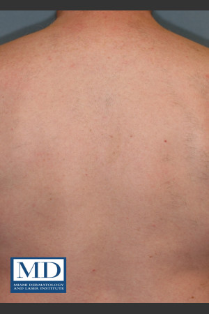 After Photo