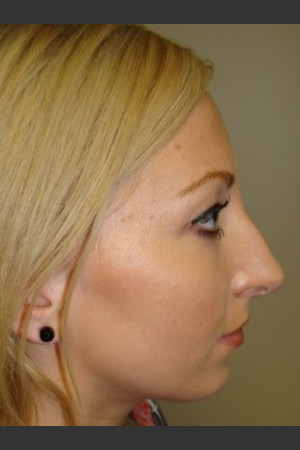 Before Photo