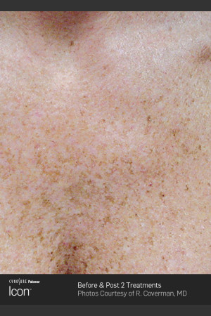 Before Photo