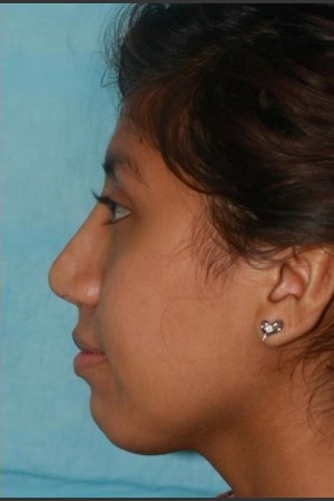 After Photo