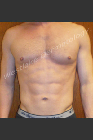 After Photo