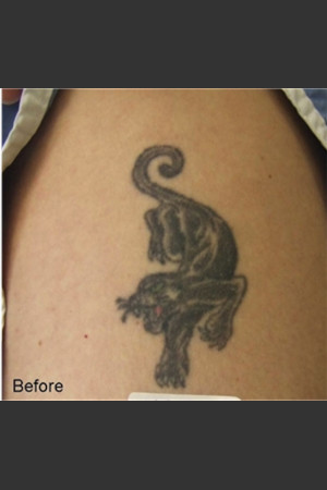 Before Photo