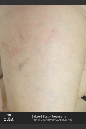 After Photo