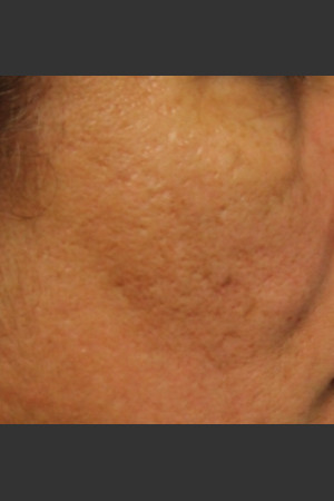 After Photo