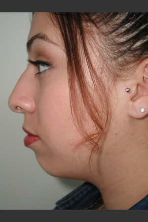 Before Photo