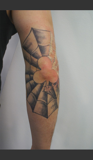 Before Photo for Quanta Q-Plus C Laser Tattoo Removal #71 -  - Prejuvenation