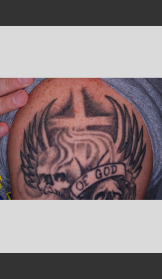 Before Photo for PicoWay Tattoo Removal on Shoulder  -  - Prejuvenation