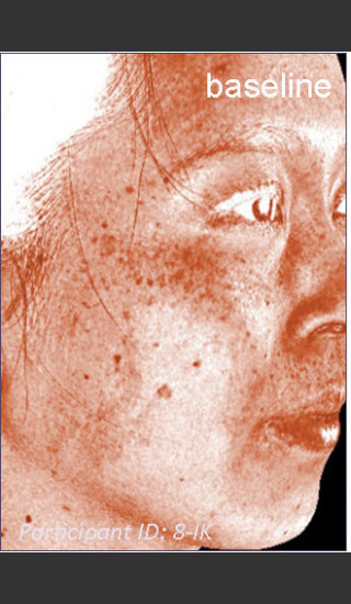 Before Photo for DefenAge Clinical Power Trio -  - Prejuvenation