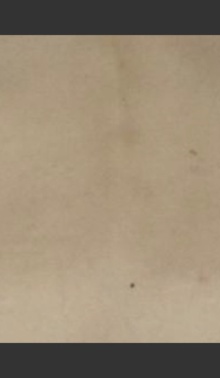 After Photo for Quanta Eterna IPL Hair Removal #75 -  - Prejuvenation