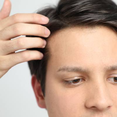 What is the Cost of <b>Hair</b> Restoration?