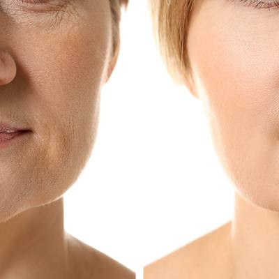 What is the Cost of Wrinkle Reduction Treatments?