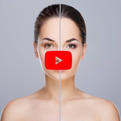 Is Cold The Future Of Targeting Pigmented Skin?