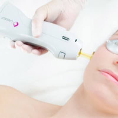GentleLase Review: GentleLase <b>Hair</b> Removal