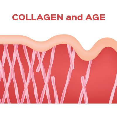 How to Prevent Collagen <b>Loss</b> as You Age