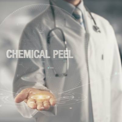What Exactly Is A Chemical Peel?