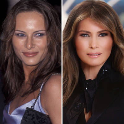 We Want to Know: Melania Trump