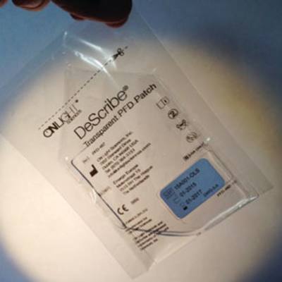 DeScribe Tattoo <b>Removal</b> Patch: Dr. Biesman on DeScribe Tattoo Patch
